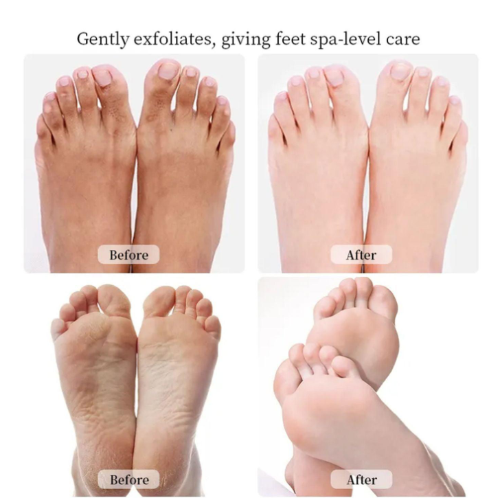 Beacysw Jelly Spa